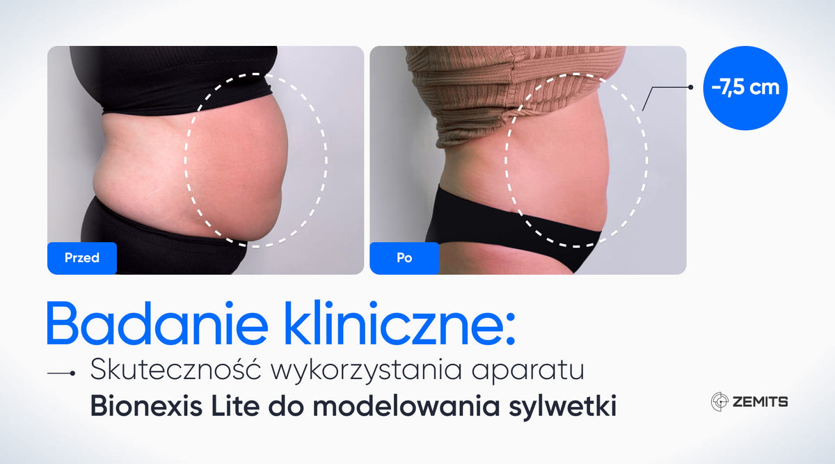 Badanie kliniczne: Skuteczność wykorzystania aparatu Bionexis Lite do modelowania sylwetki