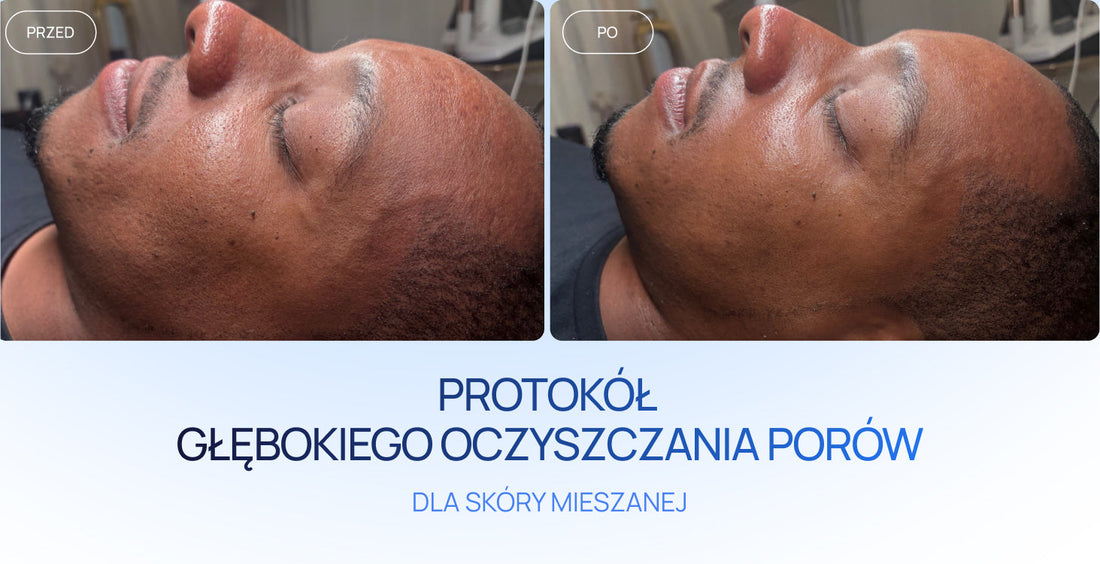 PROTOKÓŁ GŁĘBOKIEGO OCZYSZCZANIA PORÓW DLA SKÓRY MIESZANEJ