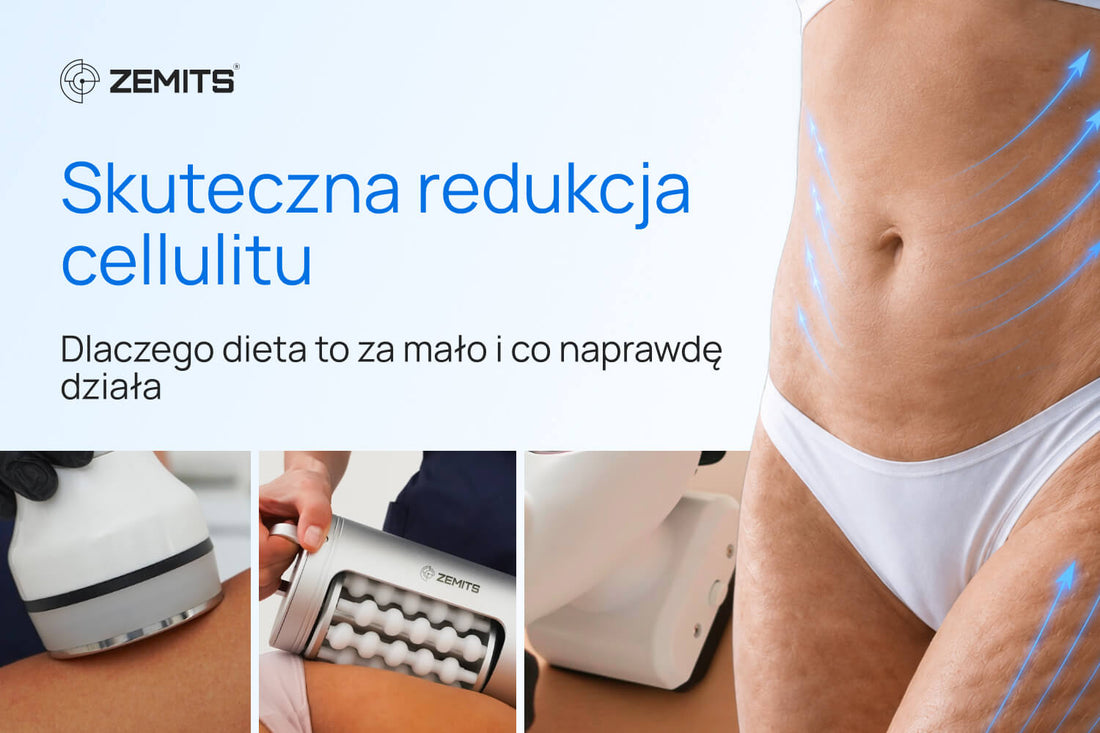Skuteczna redukcja cellulitu: dlaczego dieta to za mało i co naprawdę działa