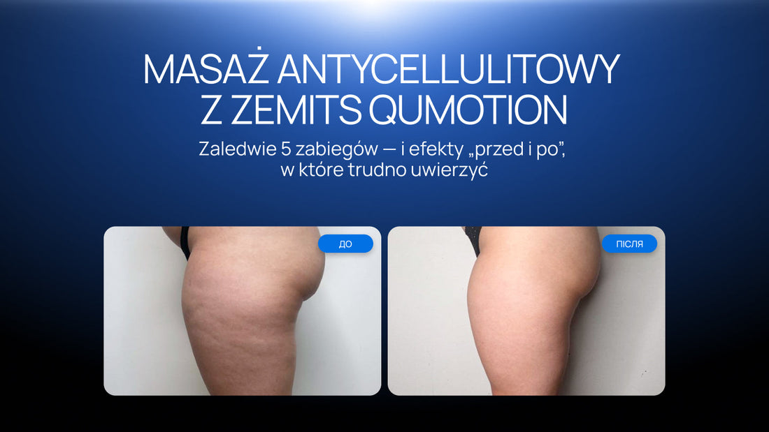 Zaledwie 5 zabiegów — i efekty „przed i po”, w które trudno uwierzyć: masaż antycellulitowy z Zemits QuMotion