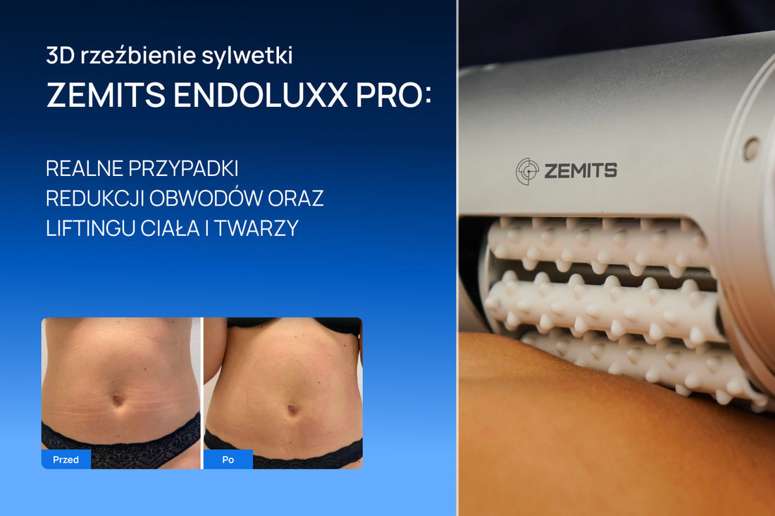 3D rzeźbienie sylwetki z wykorzystaniem Zemits Endoluxx Pro: realne rezultaty redukcji obwodów oraz liftingu ciała i twarzy