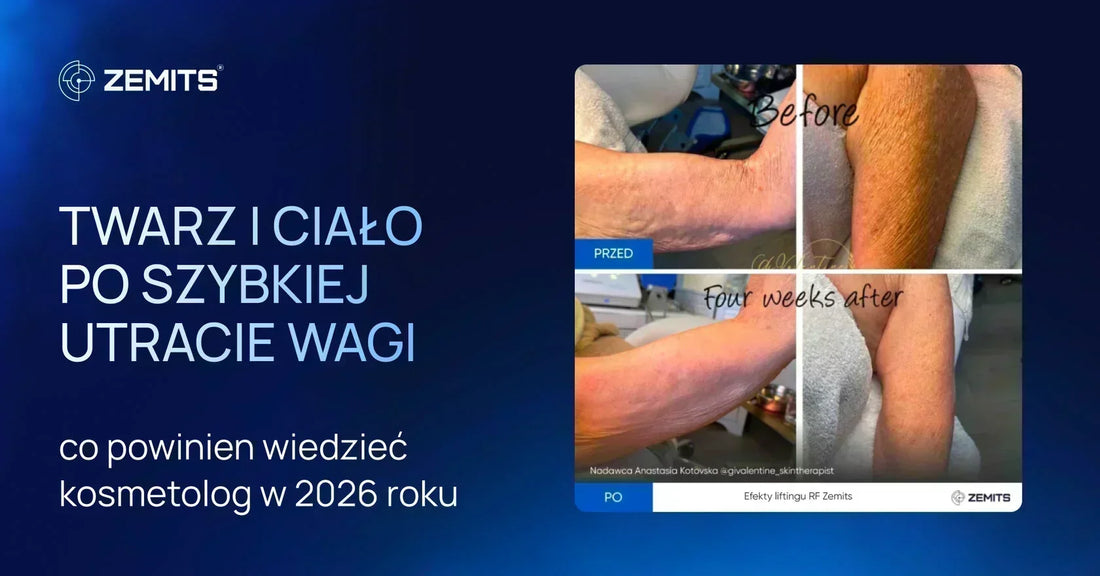 Twarz i ciało po szybkiej utracie wagi: co powinien wiedzieć kosmetolog w 2026 roku