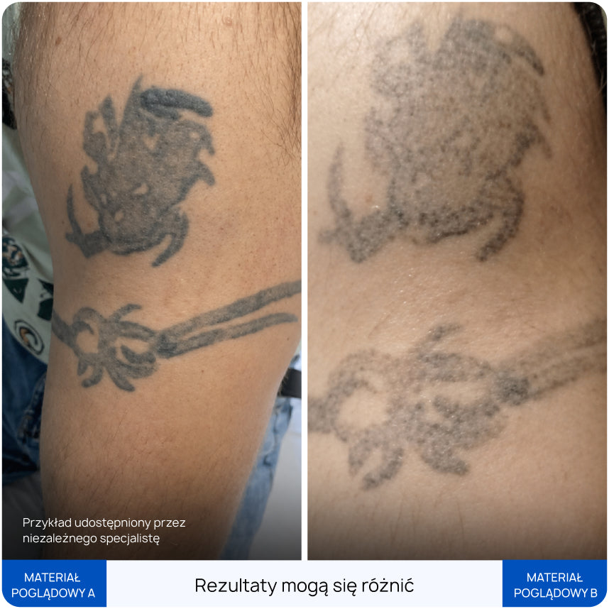 Before After Slide 3