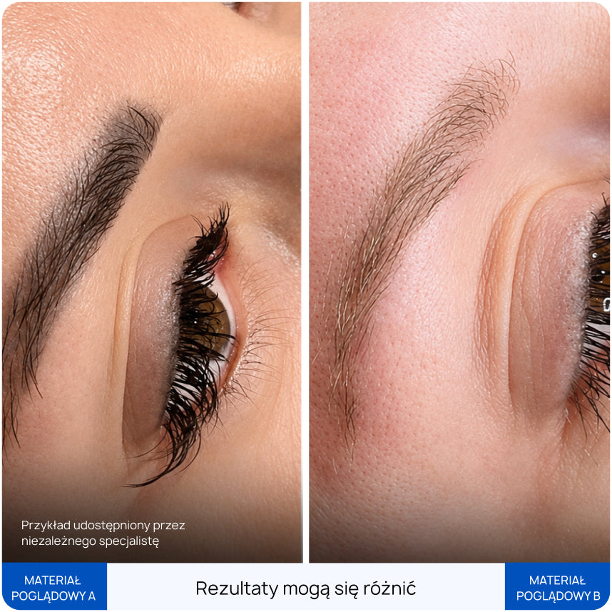 Before After Slide 1