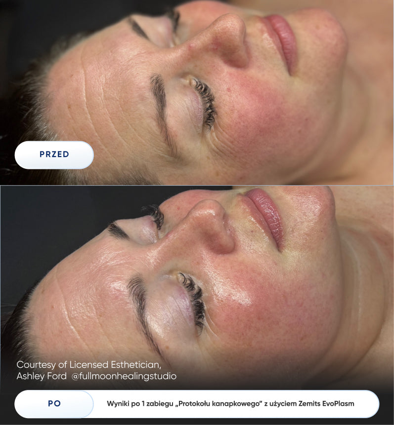 Before After Slide 3