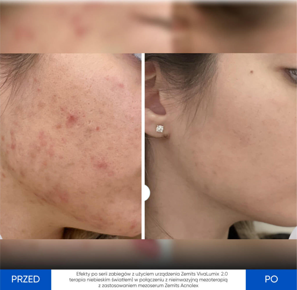 Before After Slide 2