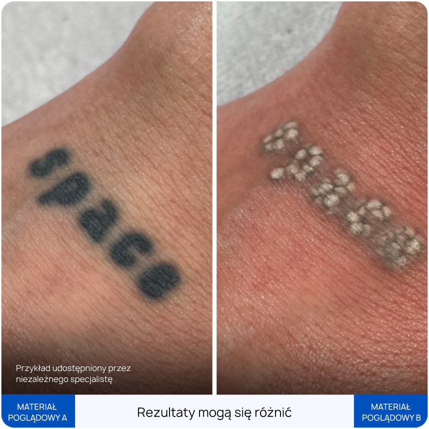 Before After Slide 4
