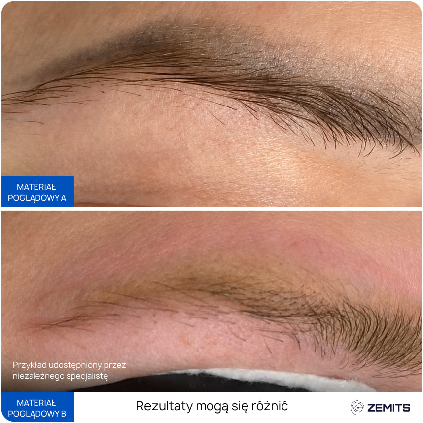Before After Slide 5