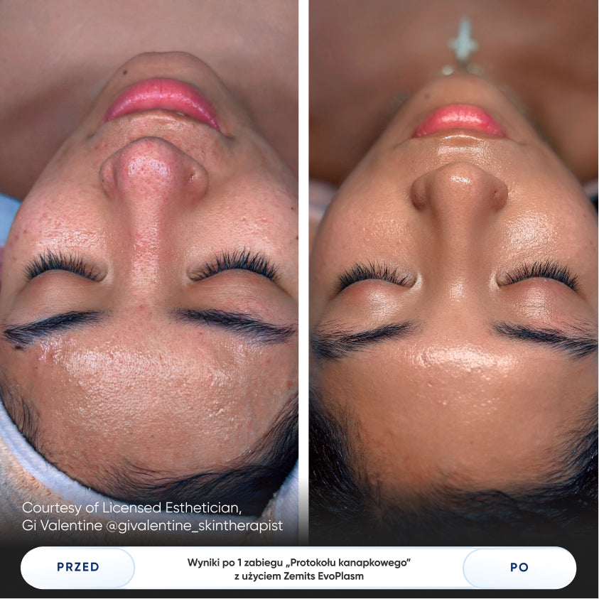Before After Slide 5