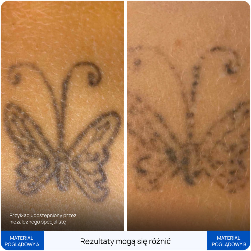 Before After Slide 6