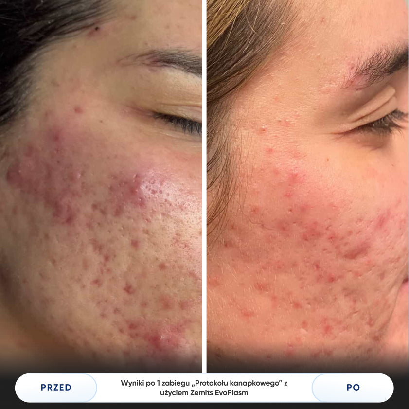 Before After Slide 6