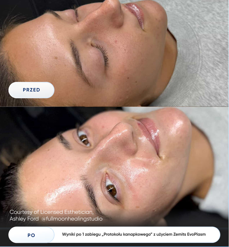 Before After Slide 2
