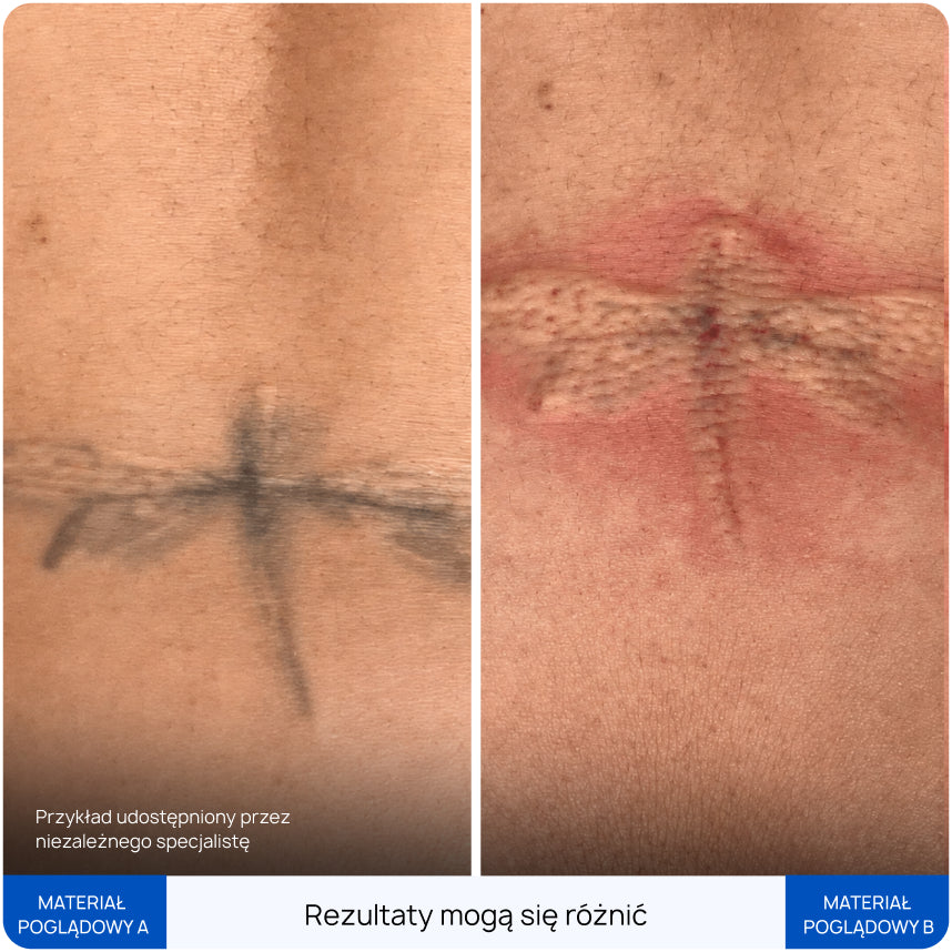 Before After Slide 7