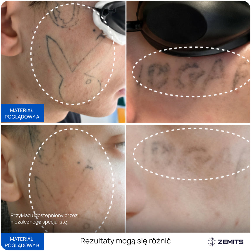 Before After Slide 8