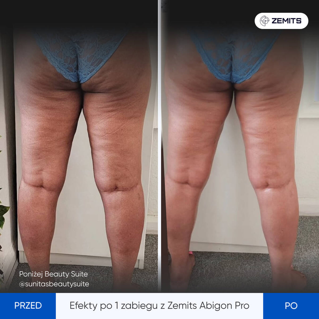 Zemits Abigon Pro