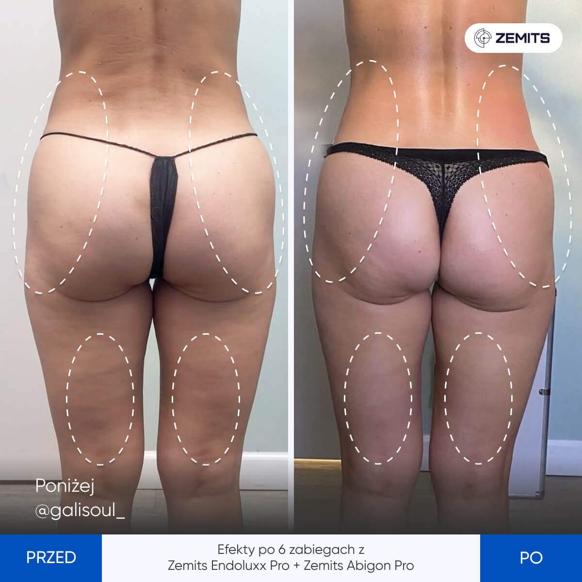 Before After Slide 4
