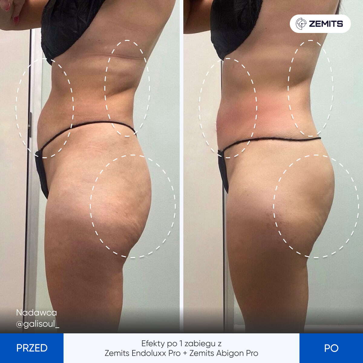 Before After Slide 5