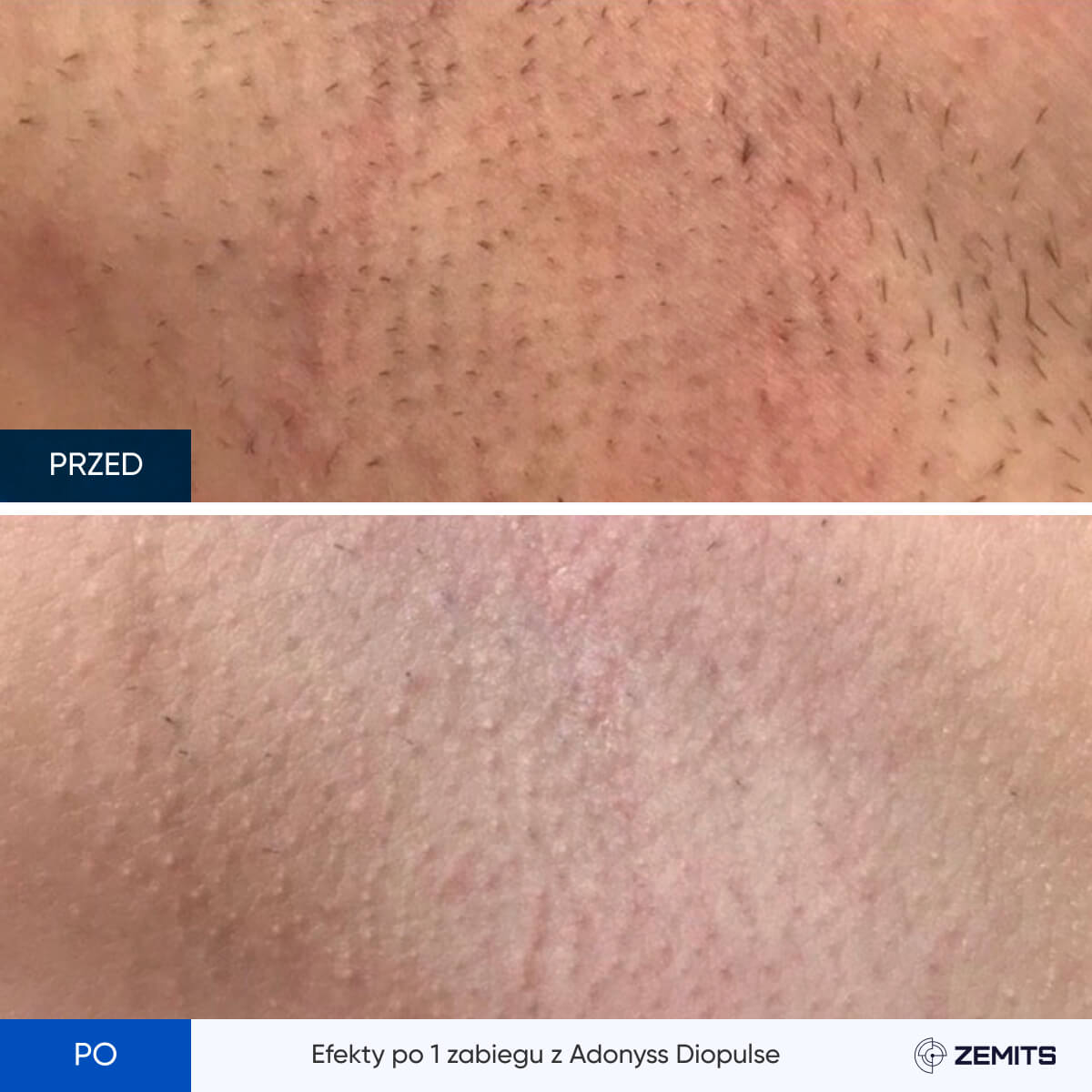 Before After Slide 4