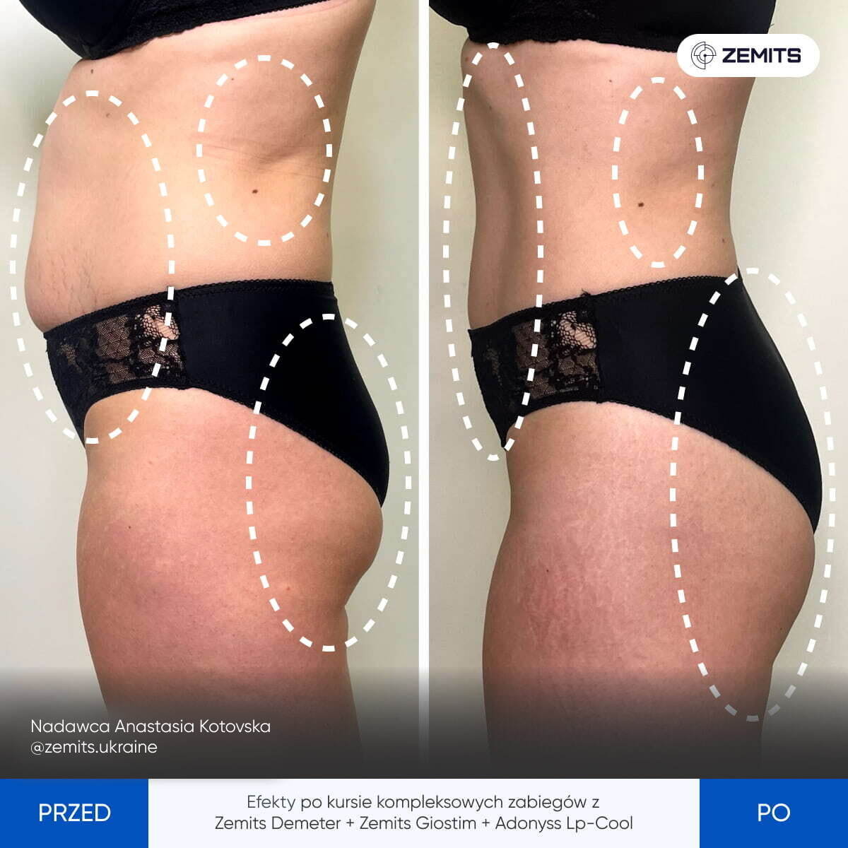 Before After Slide 3