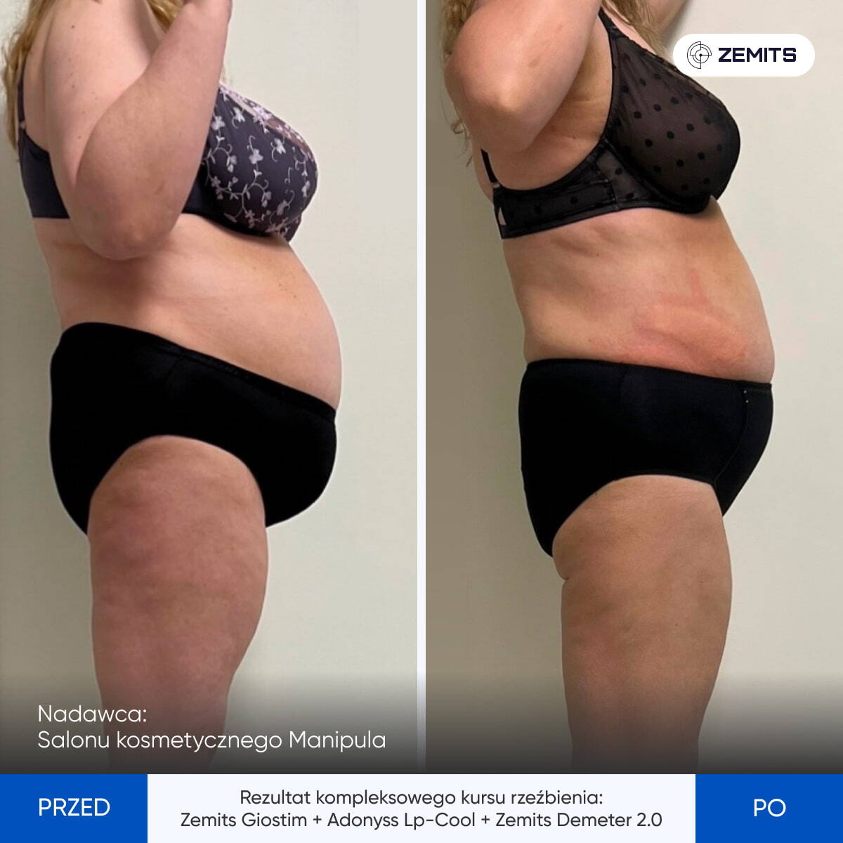 Before After Slide 4