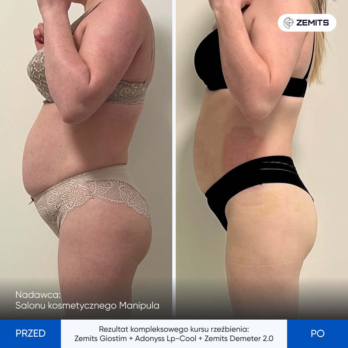 Before After Slide 5