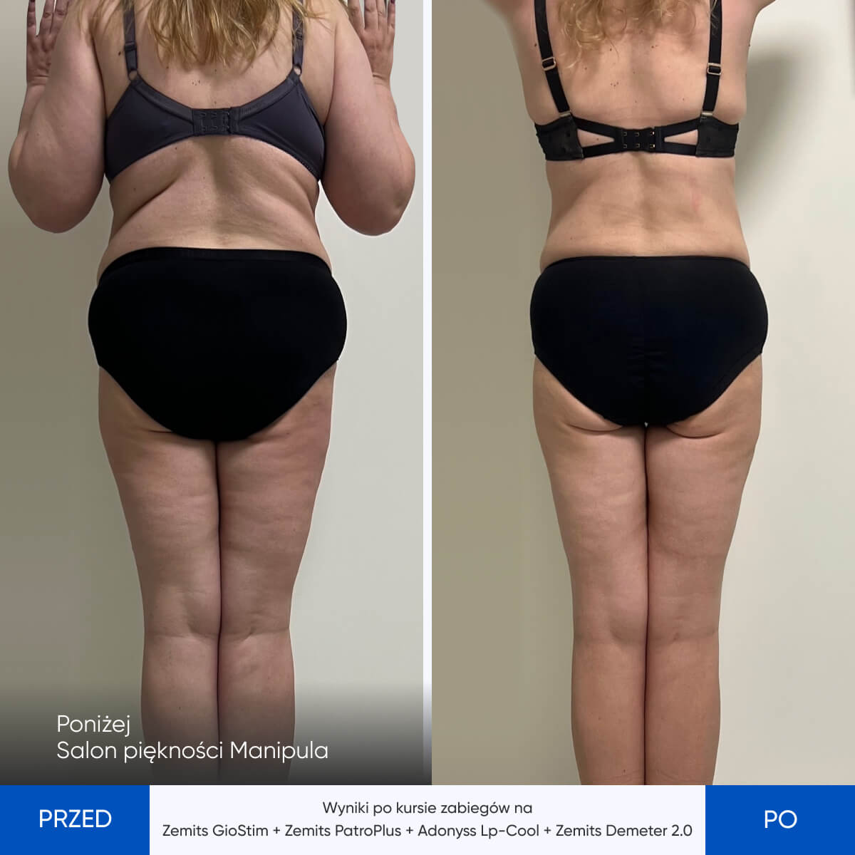 Before After Slide 7