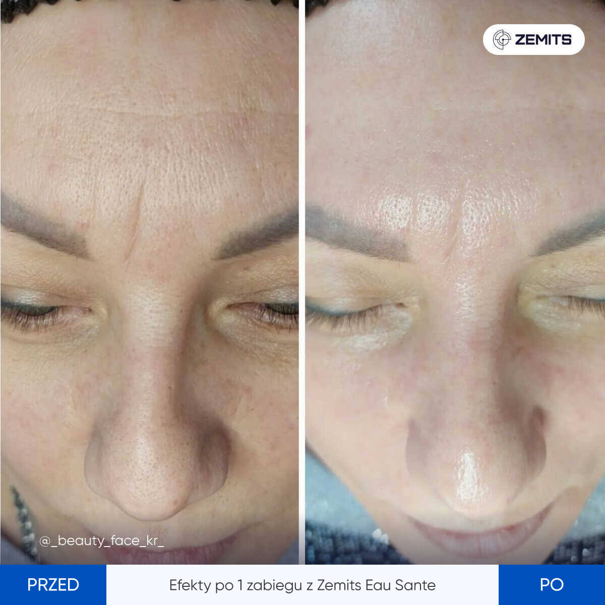 Before After Slide 2