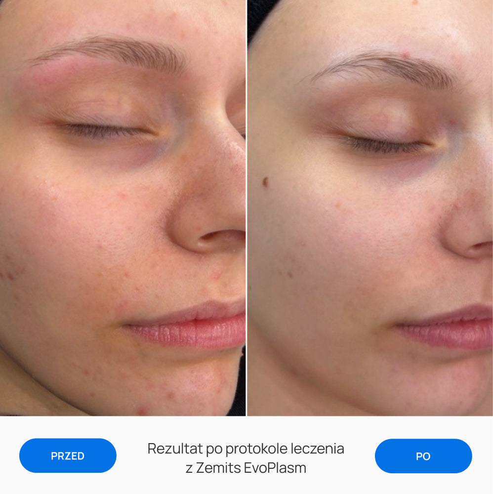 Before After Slide 1