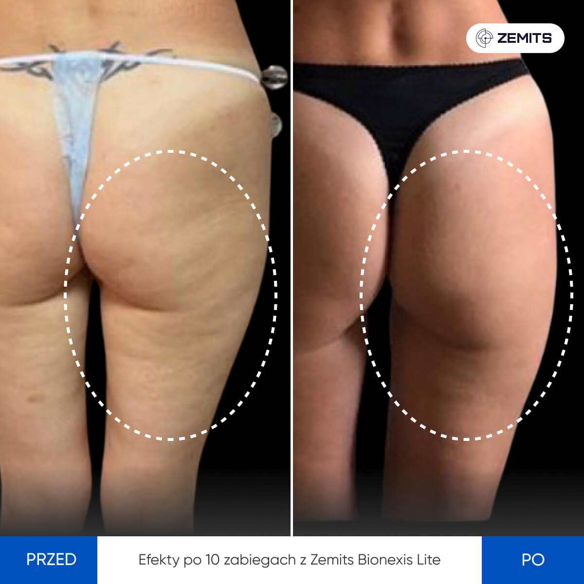 Before After Slide 3