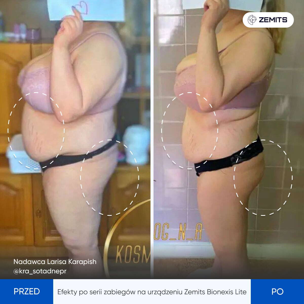 Before After Slide 7