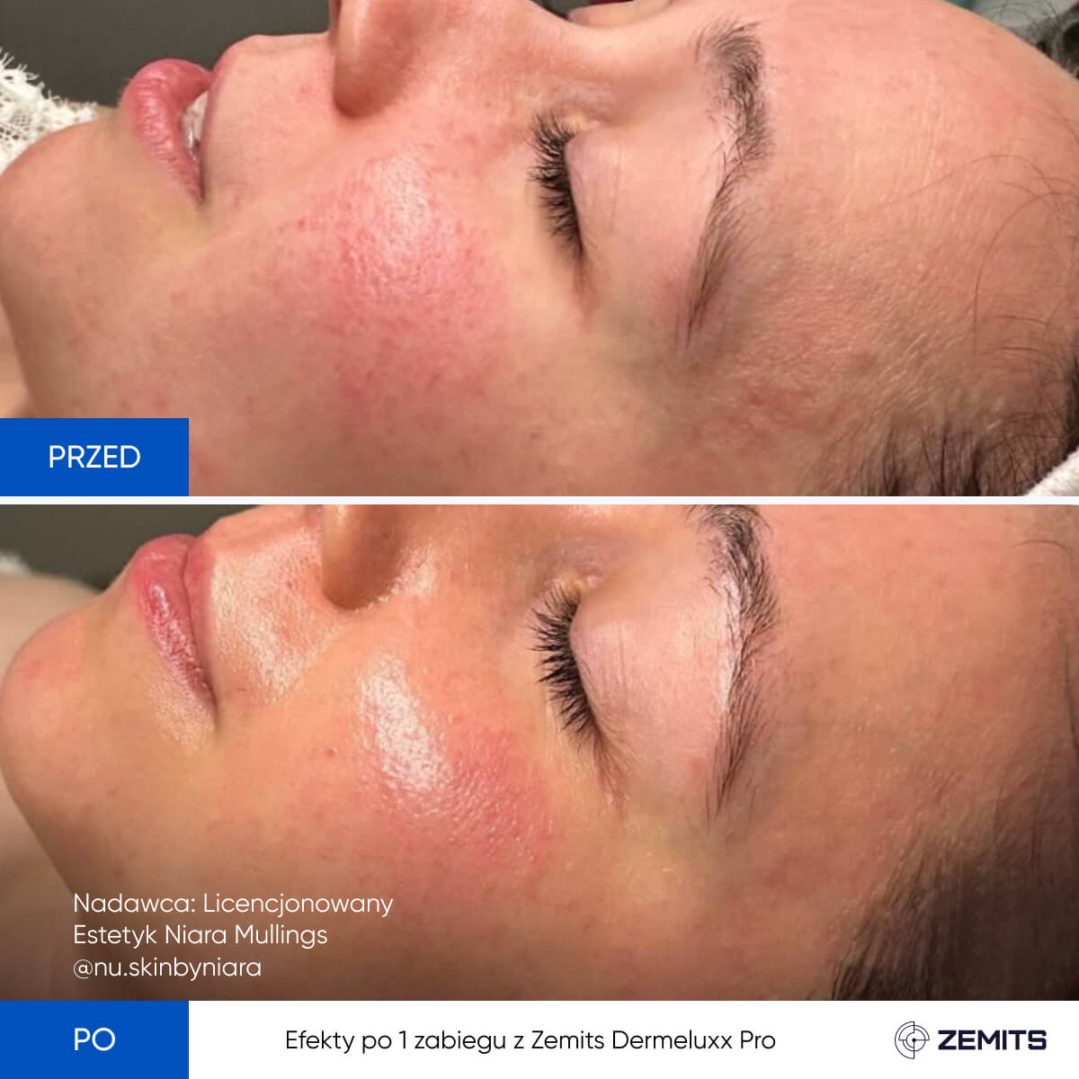 Before After Slide 6