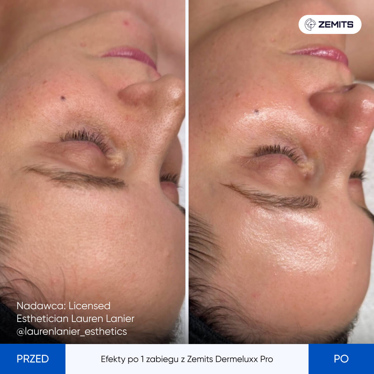 Before After Slide 7