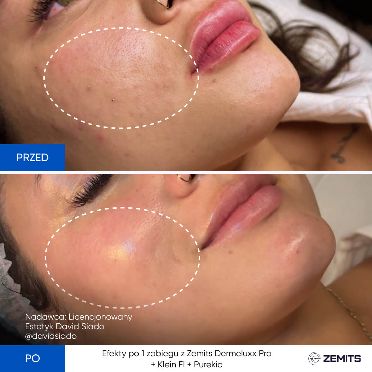 Before After Slide 14