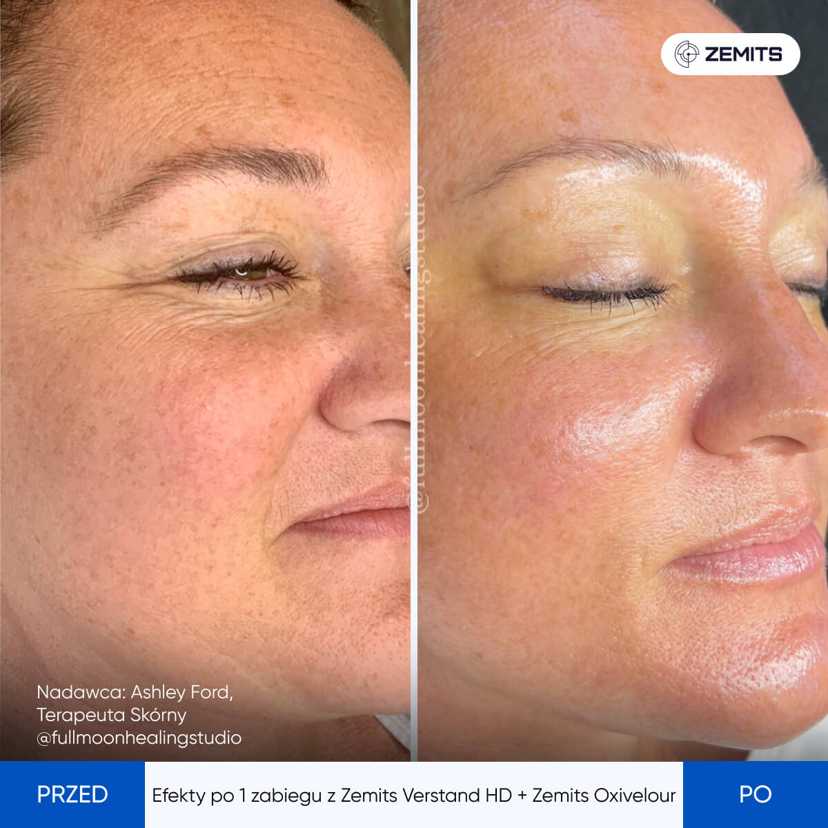 Before After Slide 8