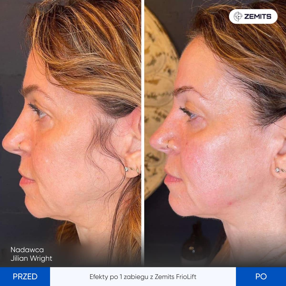 Before After Slide 6