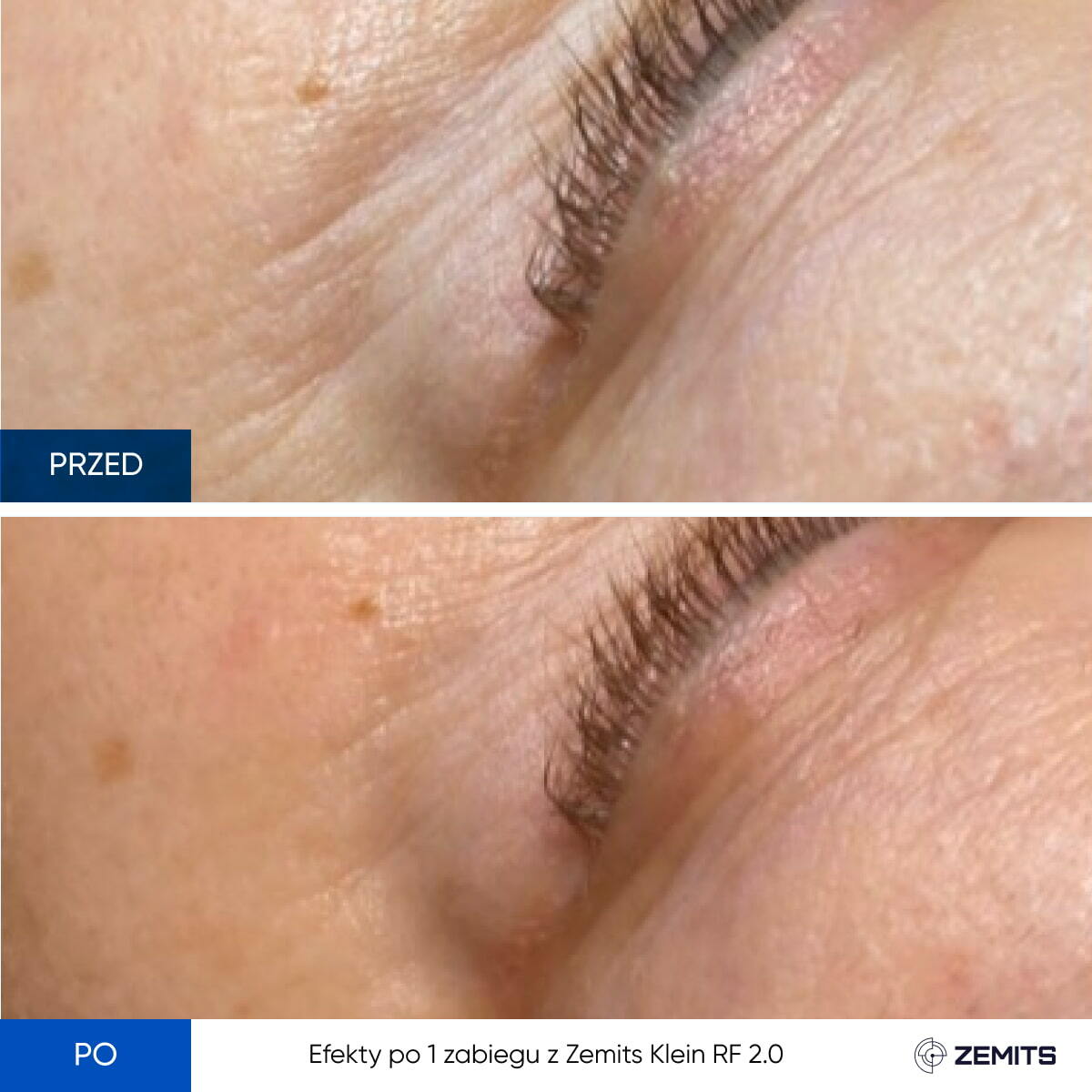 Before After Slide 1
