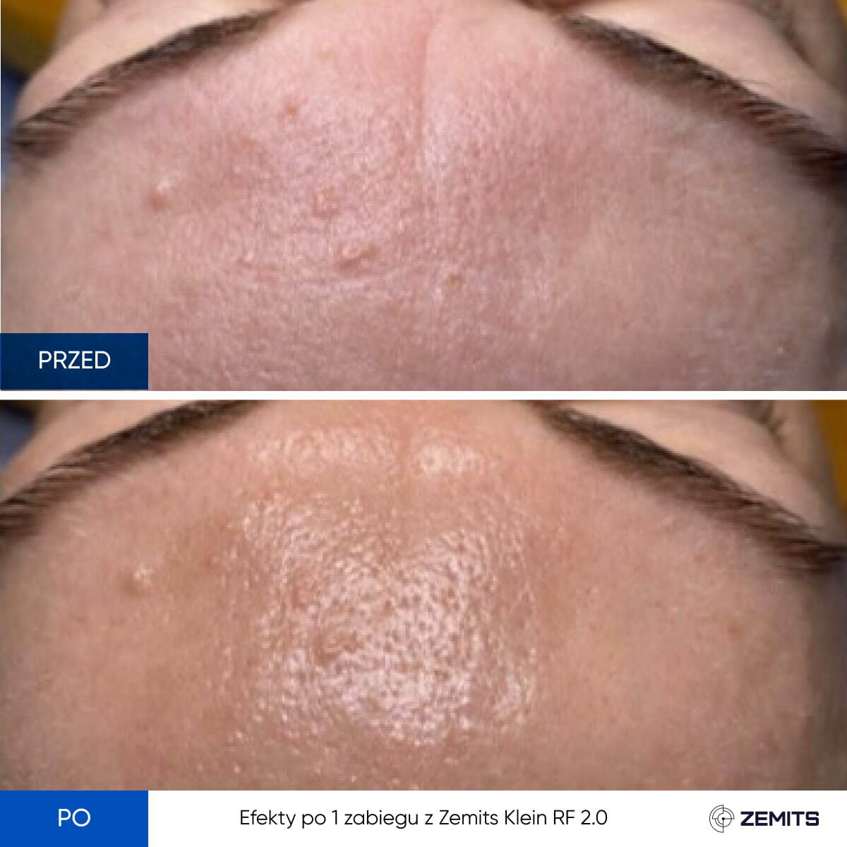 Before After Slide 2