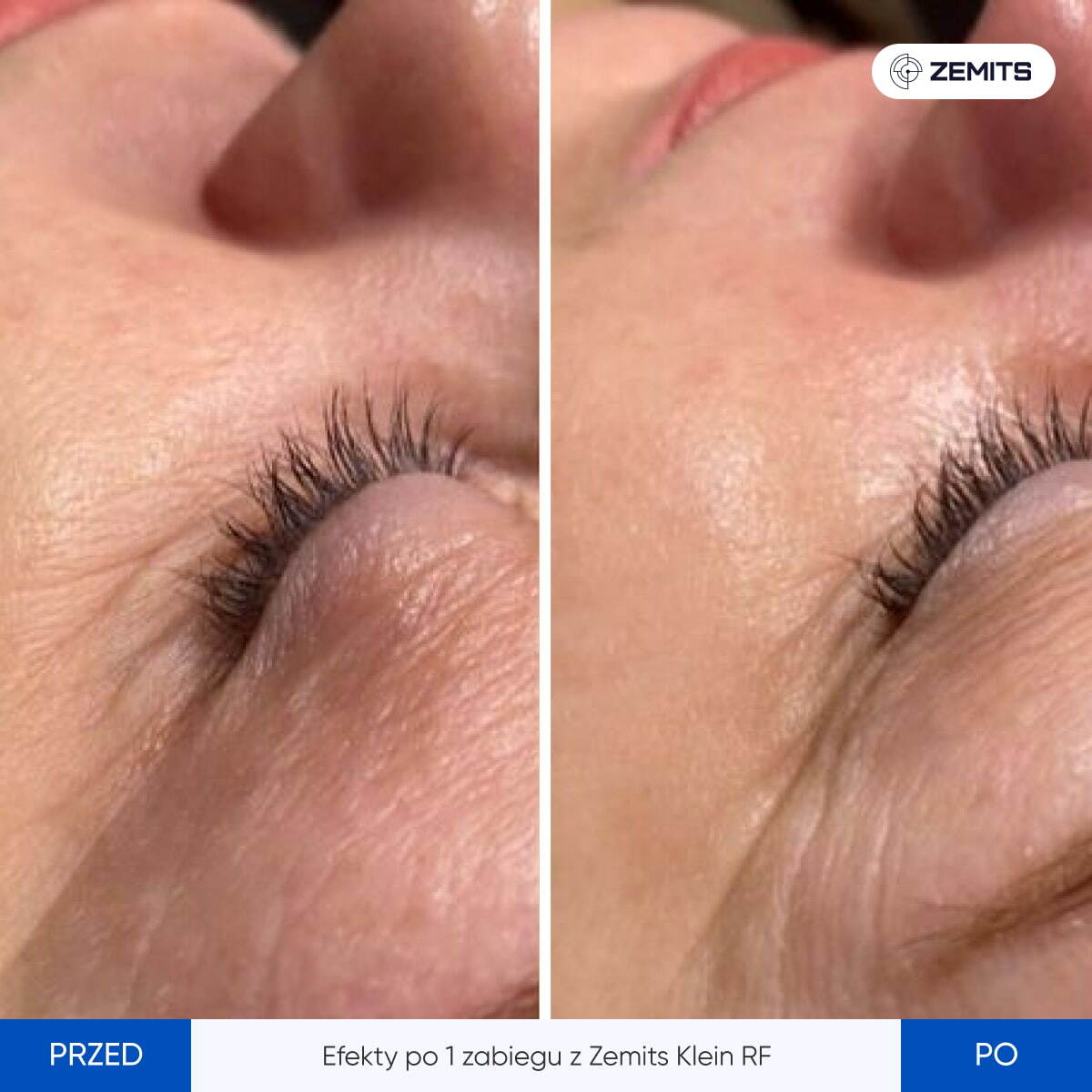 Before After Slide 3