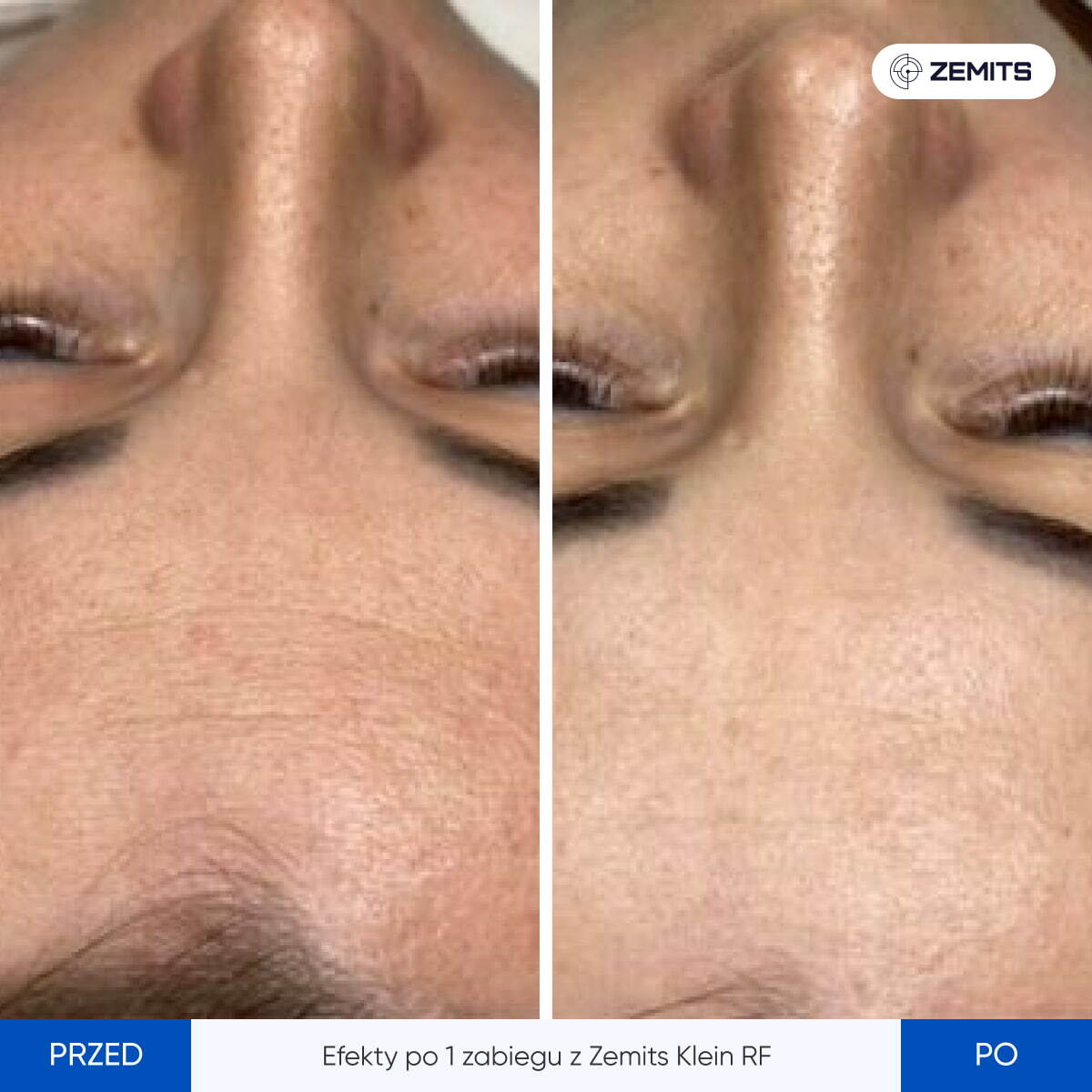 Before After Slide 4