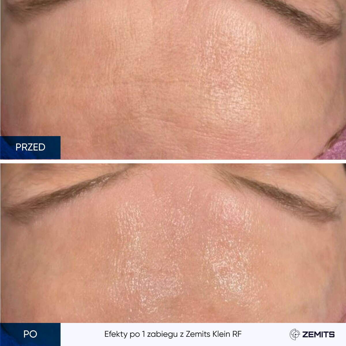 Before After Slide 5