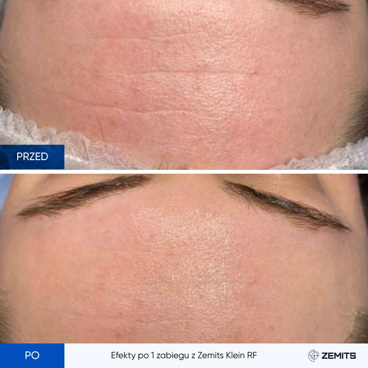 Before After Slide 6