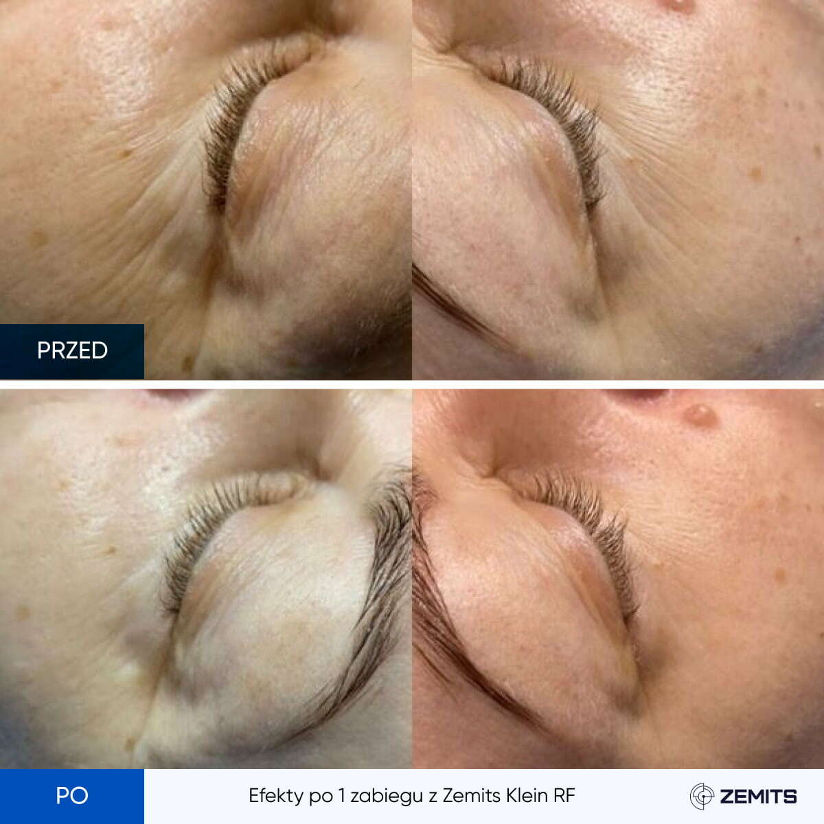Before After Slide 7