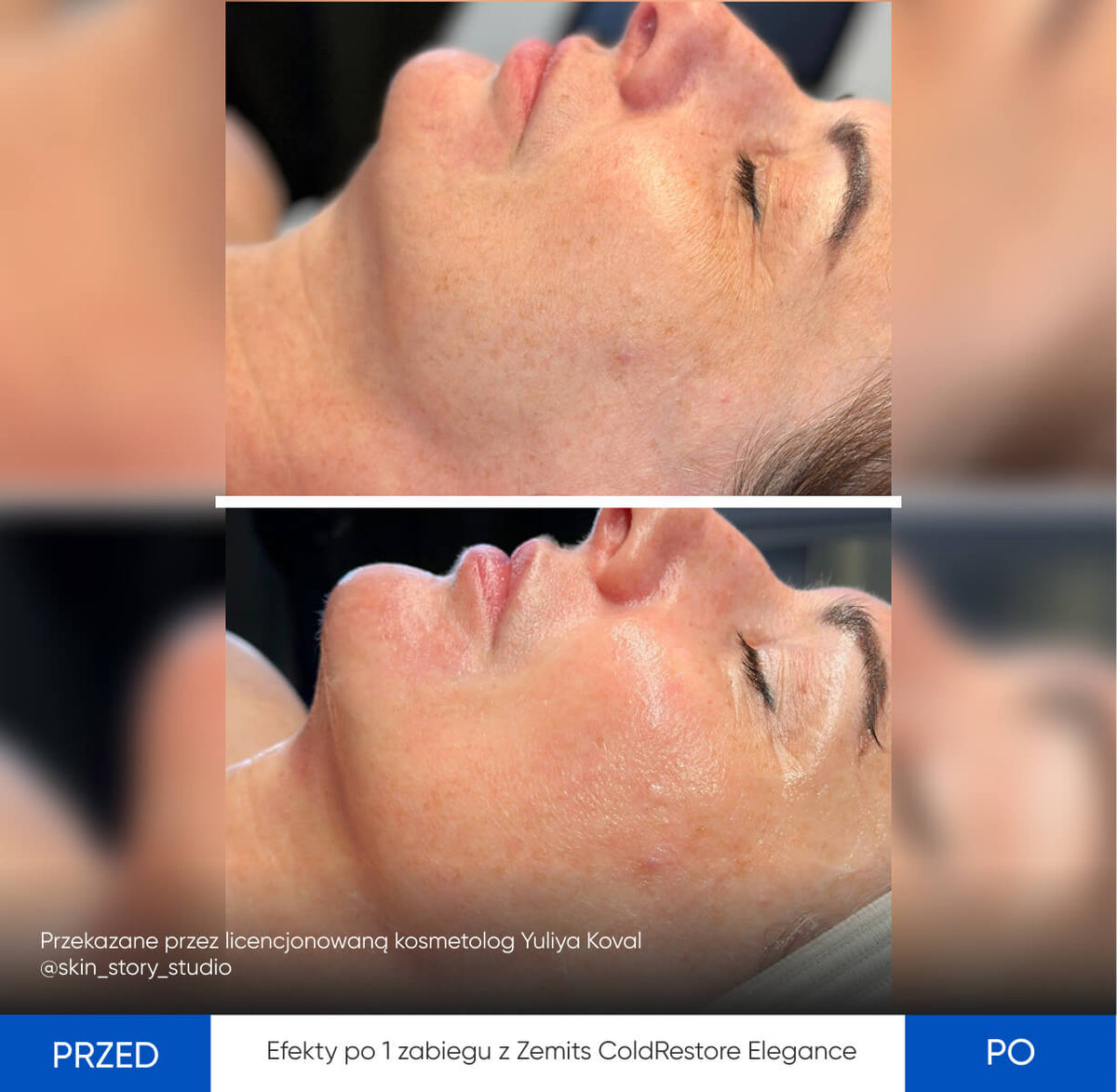 Before After Slide 2
