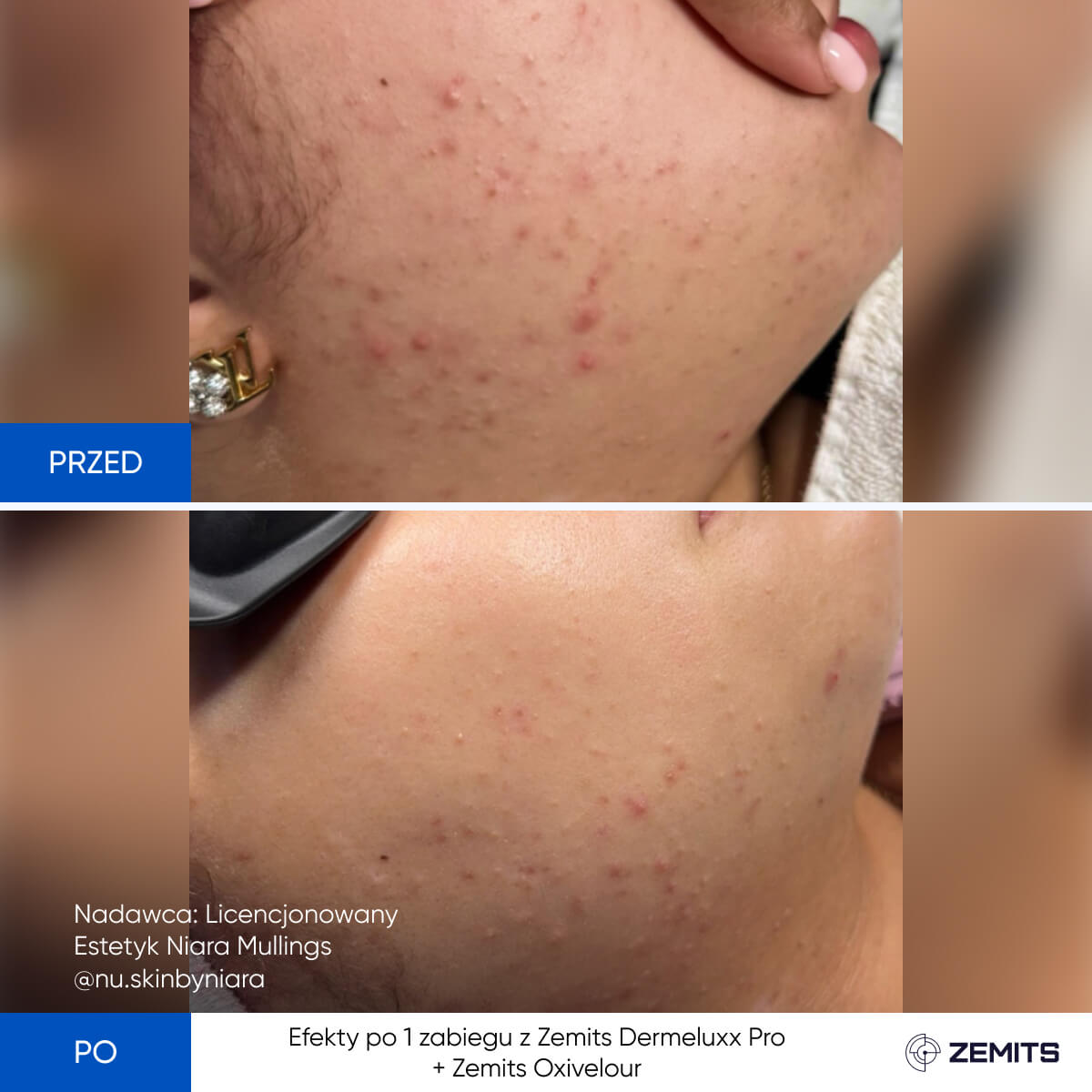 Before After Slide 5