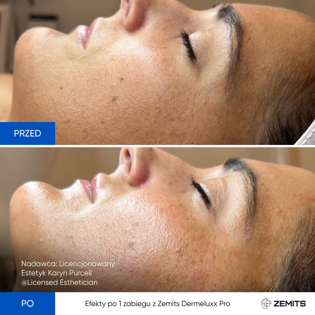 Before After Slide 8
