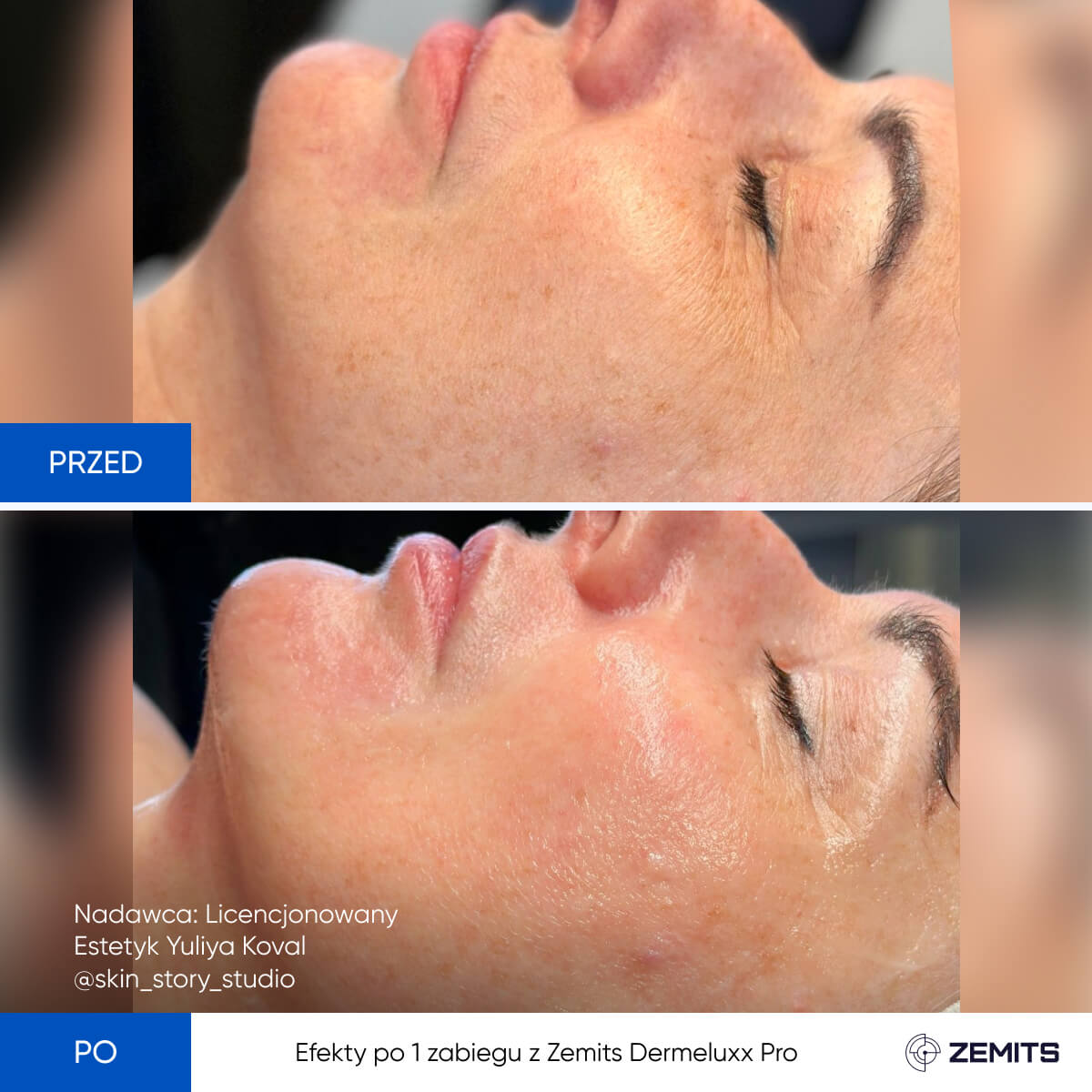 Before After Slide 9