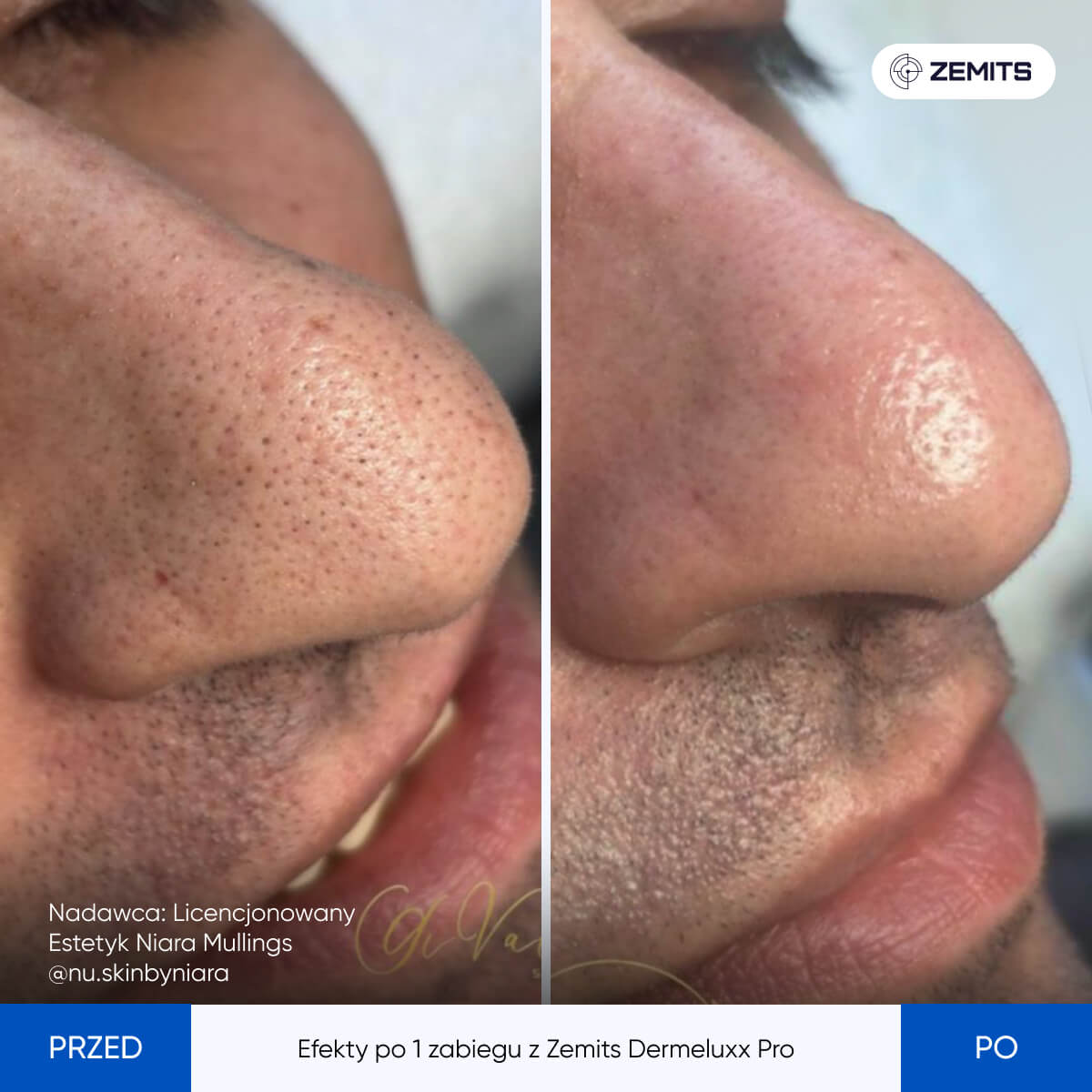 Before After Slide 10