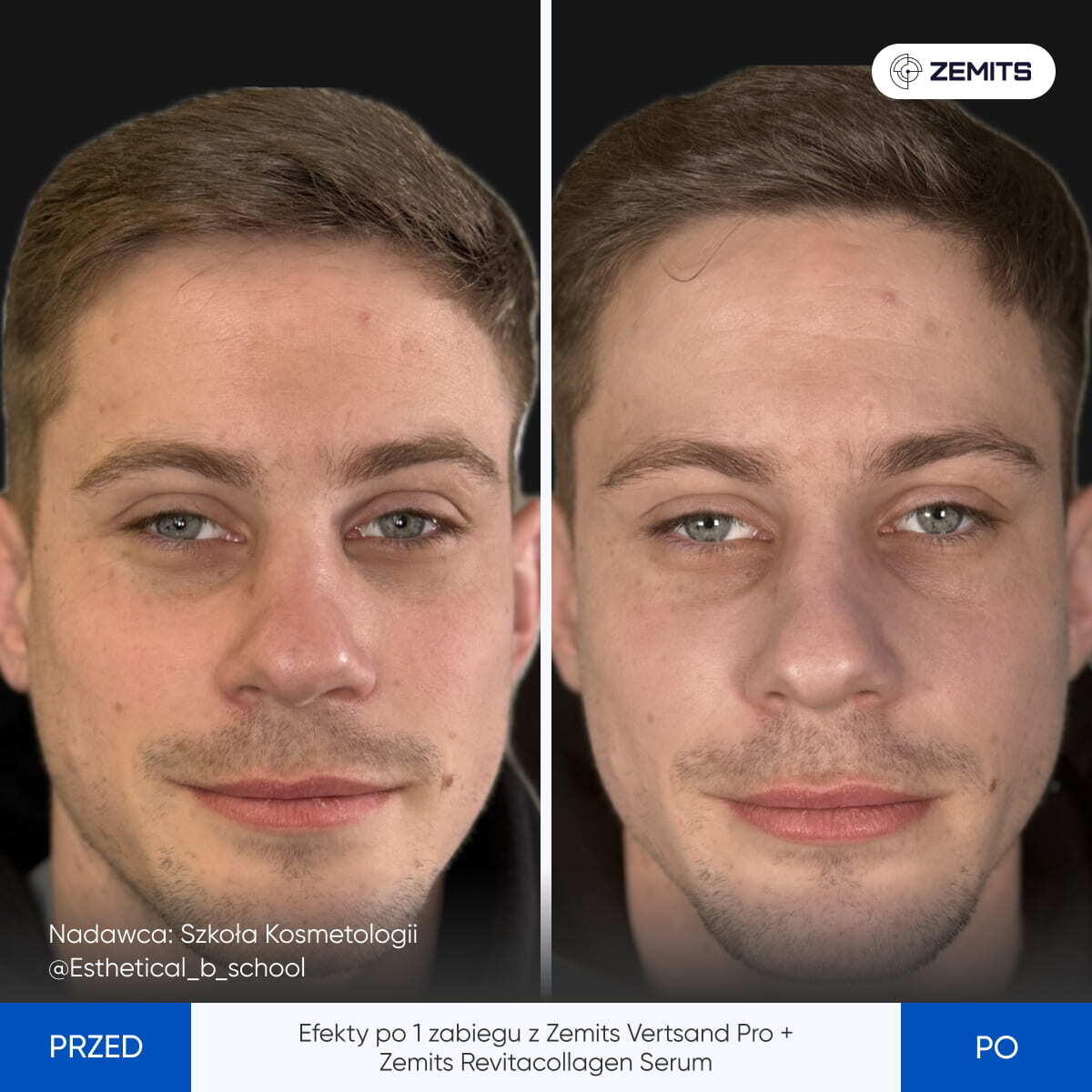 Before After Slide 1