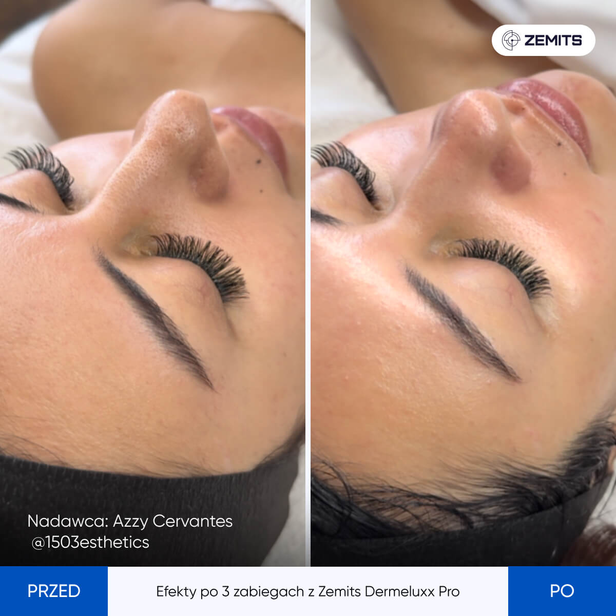Before After Slide 2