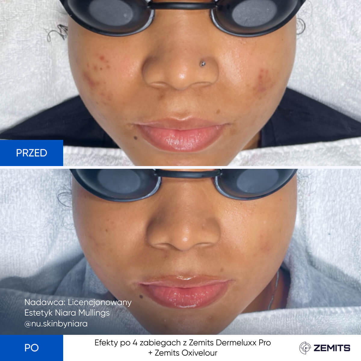 Before After Slide 16